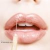 Lire cet article : Femmes arabes et chirurgie esth�tique