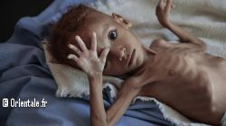 Famine au Yemen