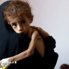Enfant souffrant de la famine