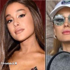 Ariana Grande Avant-Après les injections